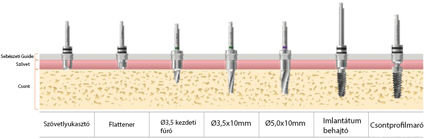 furasi.protokoll5.0x10mm.png