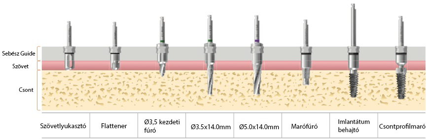 furasi.protokoll5.0x10mmoffset-13mm.png